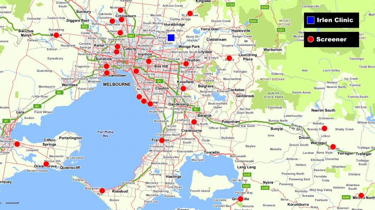 hartë më të madhe në Melburn